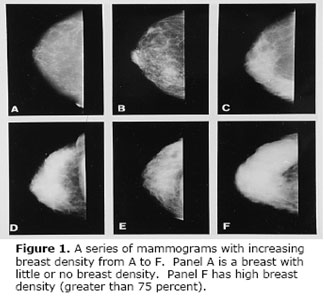 Breast Density Chart