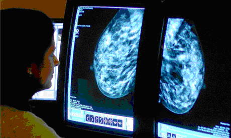 Breast Cancer Screening Causes More Damage than Previously Thought
